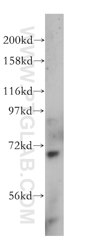 Western Blot (WB) analysis of mouse kidney tissue using NUB1 Polyclonal antibody (14343-1-AP)