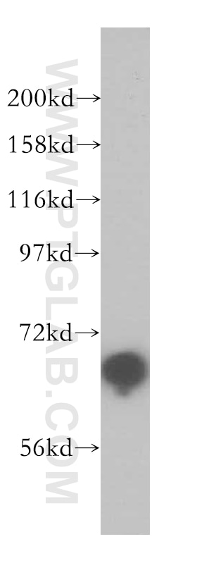 Western Blot (WB) analysis of COLO 320 cells using NUB1 Polyclonal antibody (14343-1-AP)