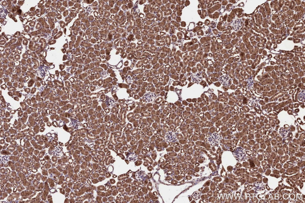 IHC staining of mouse kidney using 18011-1-AP Immunohistochemistry (IHC) staining of mouse kidney tissue using NUBP1 Polyclonal antibody (18011-1-AP)