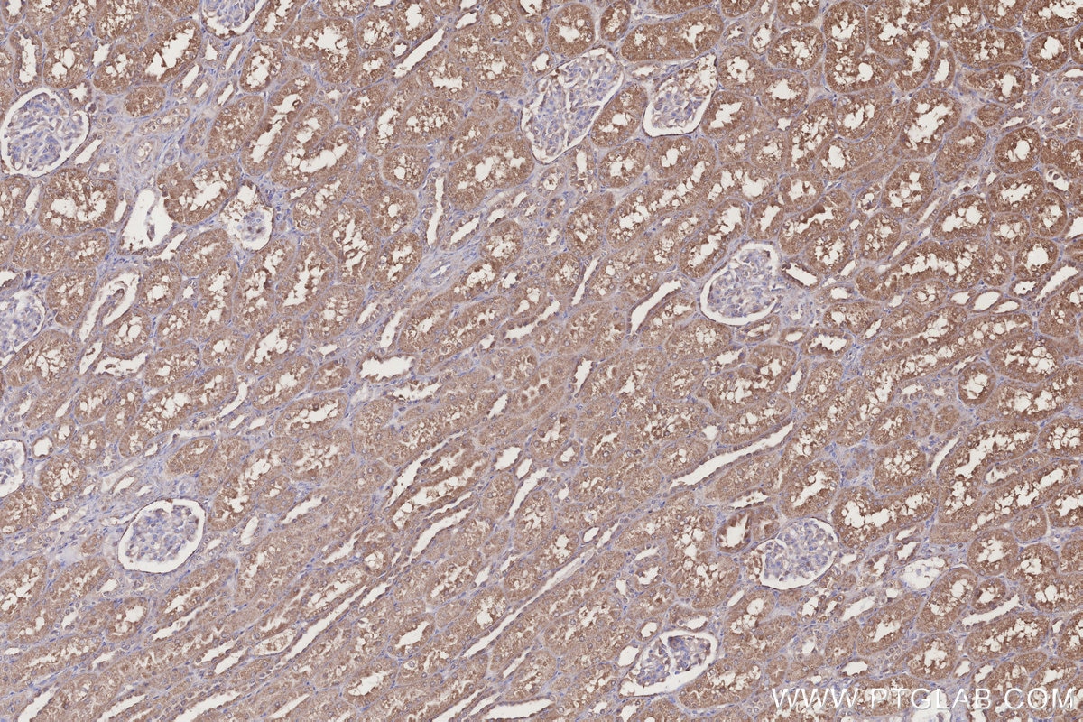 IHC staining of human kidney using 18011-1-AP Immunohistochemistry (IHC) staining of human kidney tissue using NUBP1 Polyclonal antibody (18011-1-AP)