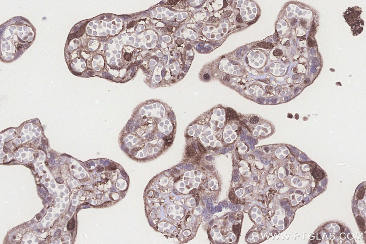 IHC staining of human placenta using 18011-1-AP Immunohistochemistry (IHC) staining of human placenta tissue using NUBP1 Polyclonal antibody (18011-1-AP)