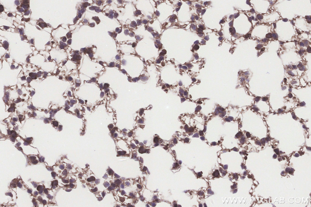 IHC staining of mouse lung using 18011-1-AP Immunohistochemistry (IHC) staining of mouse lung tissue using NUBP1 Polyclonal antibody (18011-1-AP)