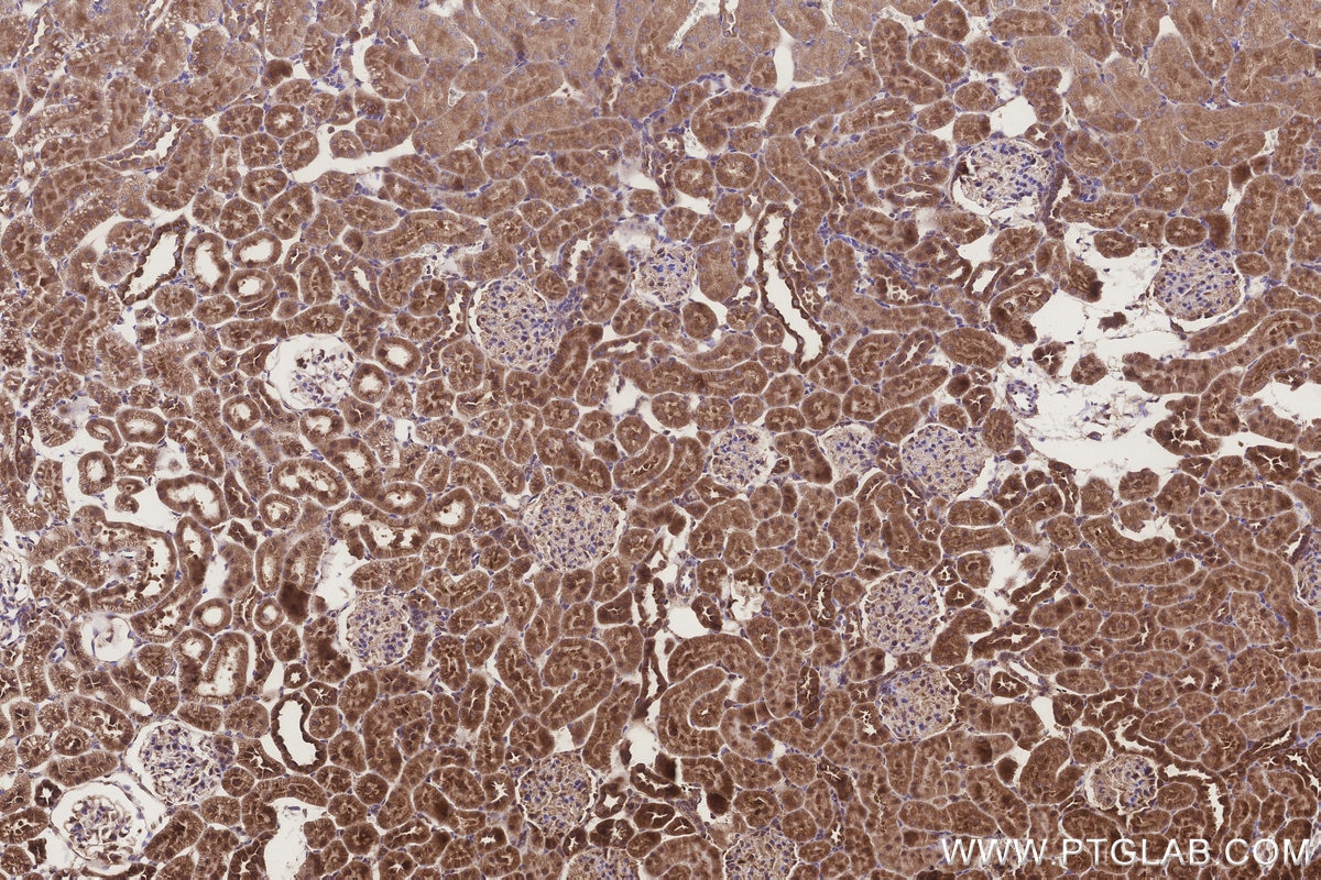 IHC staining of rat kidney using 18011-1-AP Immunohistochemistry (IHC) staining of rat kidney tissue using NUBP1 Polyclonal antibody (18011-1-AP)