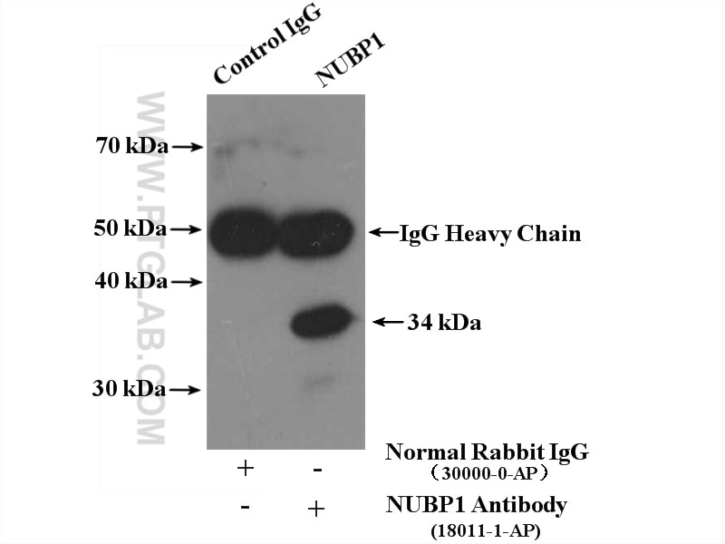 Immunoprecipitation (IP) experiment of Jurkat cells using NUBP1 Polyclonal antibody (18011-1-AP)