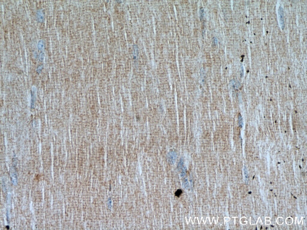 Immunohistochemistry (IHC) staining of human skeletal muscle tissue using NUBP2 Polyclonal antibody (15409-1-AP)