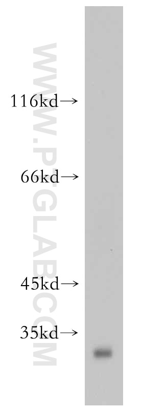 Western Blot (WB) analysis of mouse pancreas tissue using NUBP2 Polyclonal antibody (15409-1-AP)