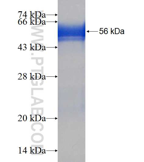 NUBP2 fusion protein Ag7676 SDS-PAGE