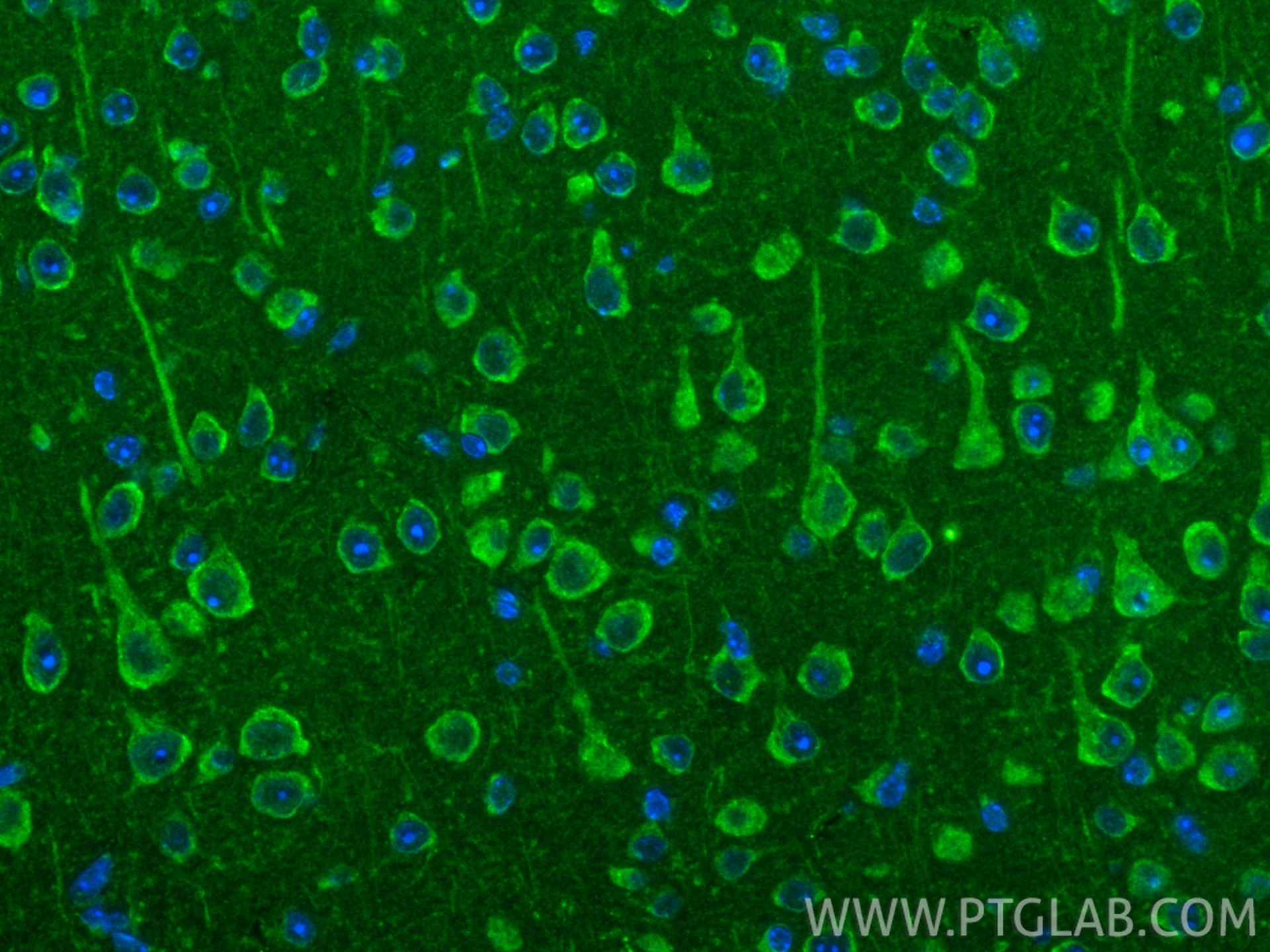 Immunofluorescence (IF) / fluorescent staining of mouse brain tissue using NUBPL Polyclonal antibody (17393-1-AP)