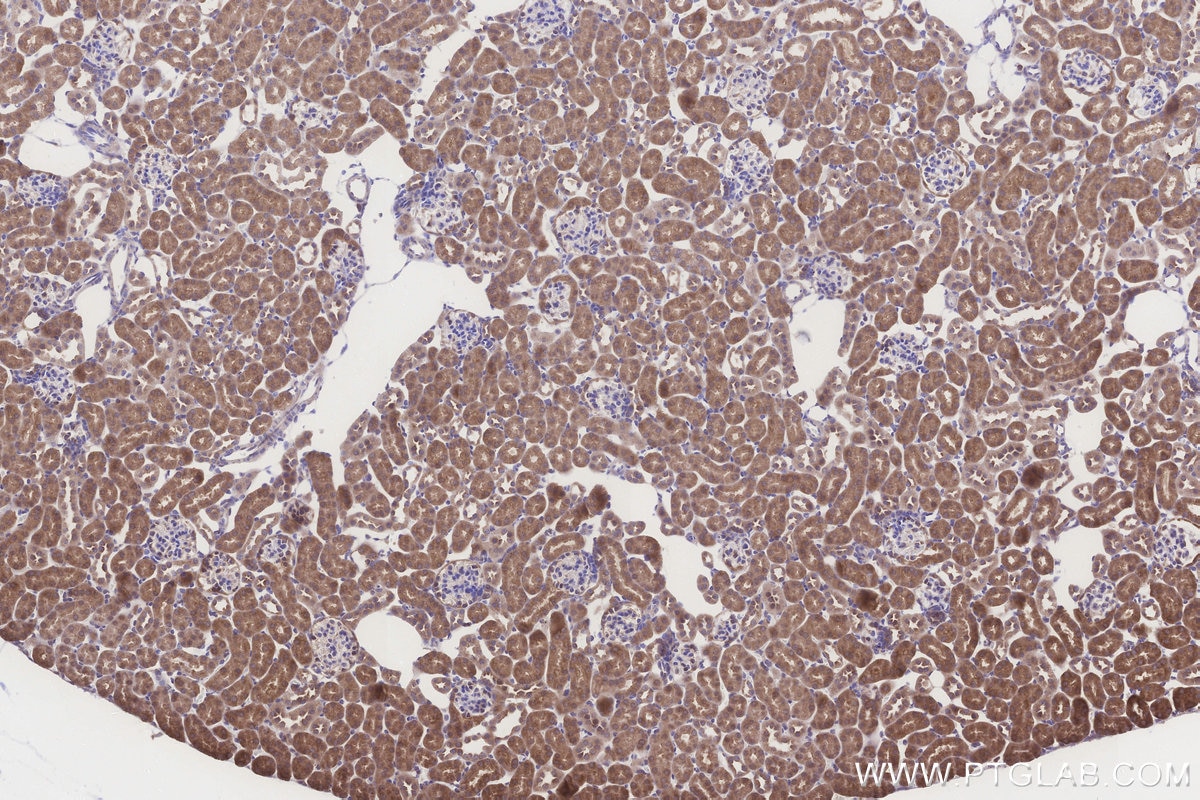 Immunohistochemistry (IHC) staining of mouse kidney tissue using NUBPL Polyclonal antibody (17393-1-AP)