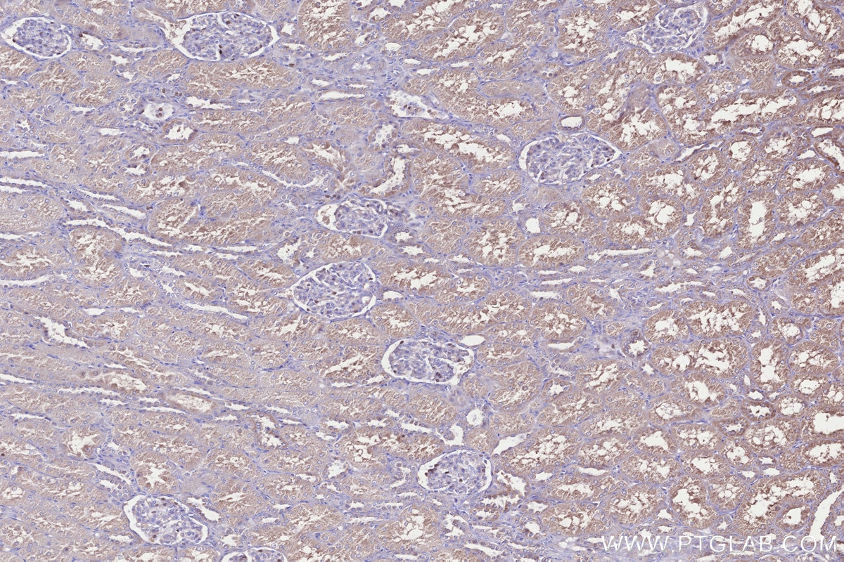 Immunohistochemistry (IHC) staining of human kidney tissue using NUBPL Polyclonal antibody (17393-1-AP)