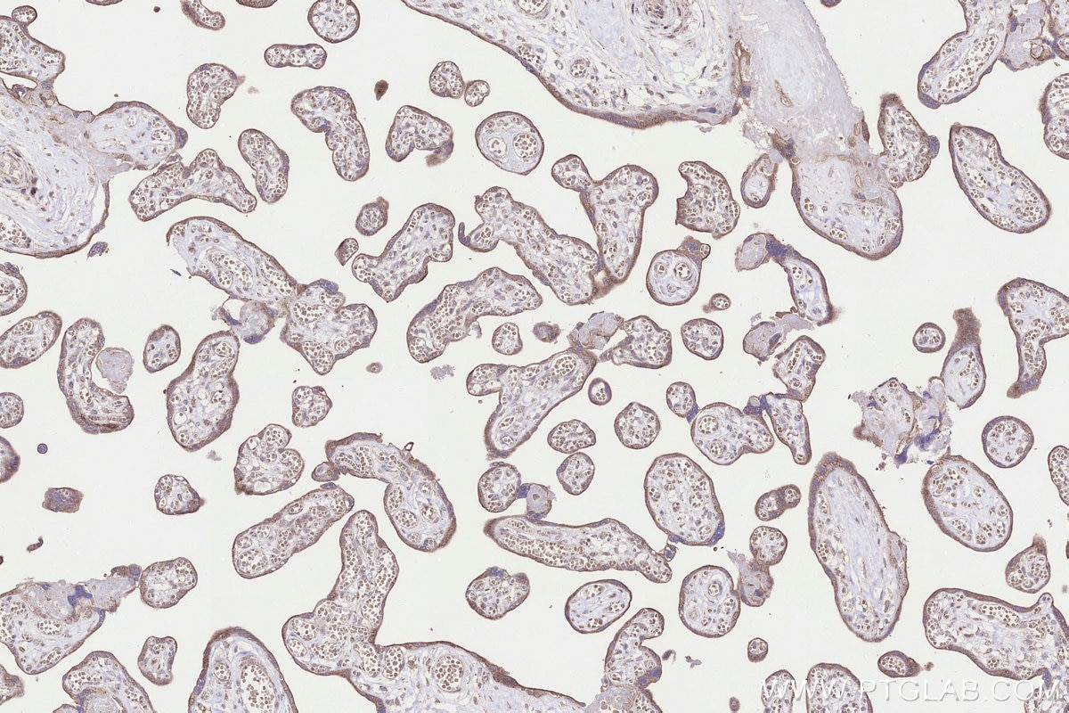 Immunohistochemistry (IHC) staining of human placenta tissue using NUBPL Polyclonal antibody (17393-1-AP)