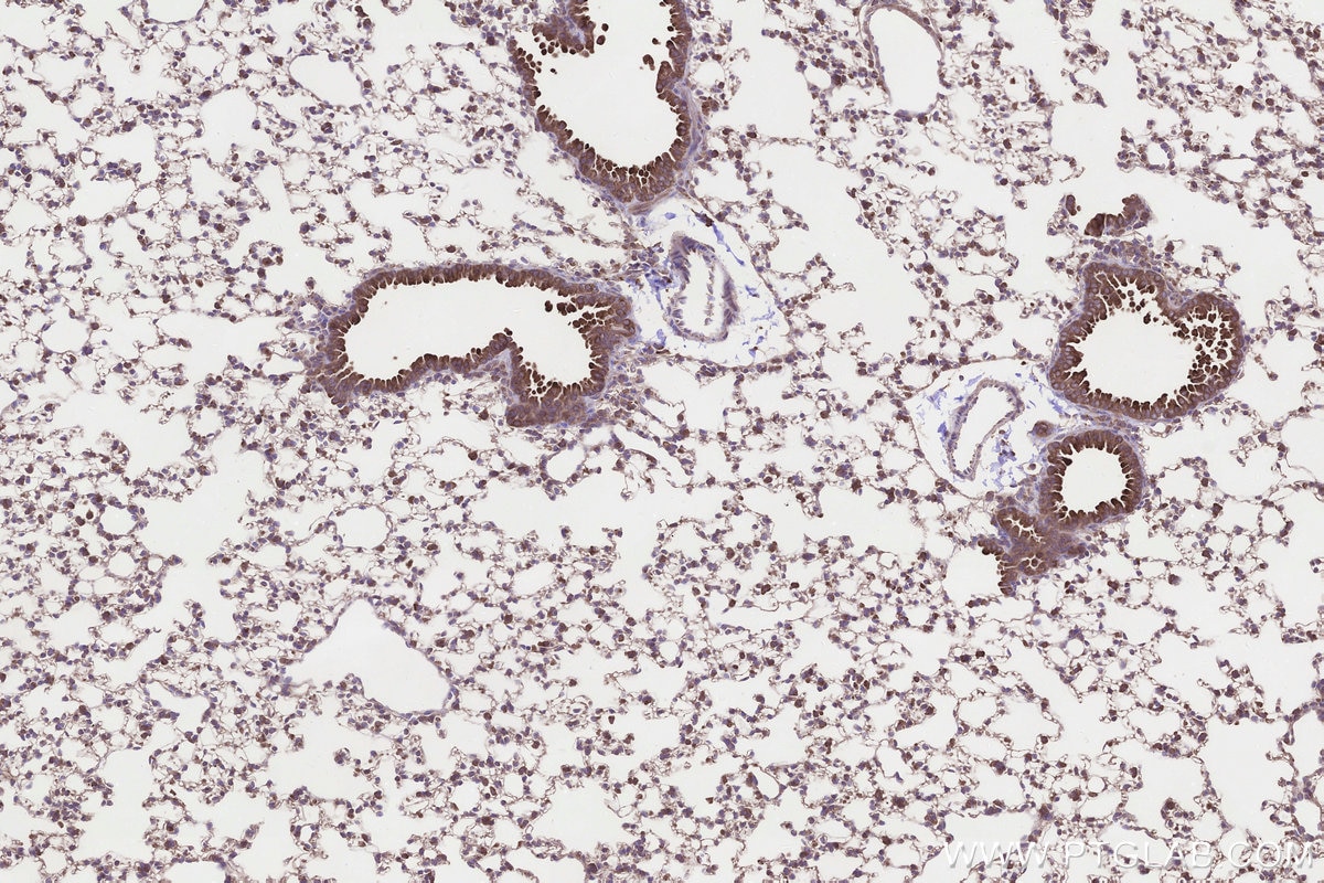 Immunohistochemistry (IHC) staining of mouse lung tissue using NUBPL Polyclonal antibody (17393-1-AP)