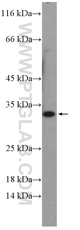 Western Blot (WB) analysis of mouse colon tissue using NUBPL Polyclonal antibody (17393-1-AP)