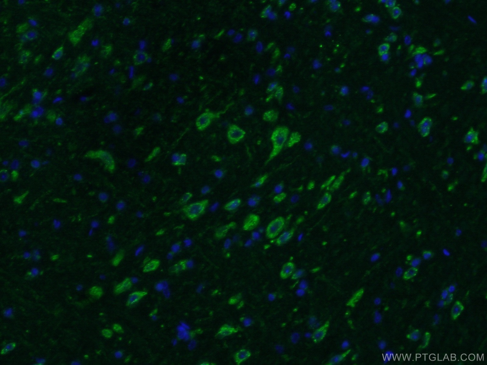 Immunofluorescence (IF) / fluorescent staining of mouse brain tissue using nucleobindin 1 Polyclonal antibody (10228-1-AP)