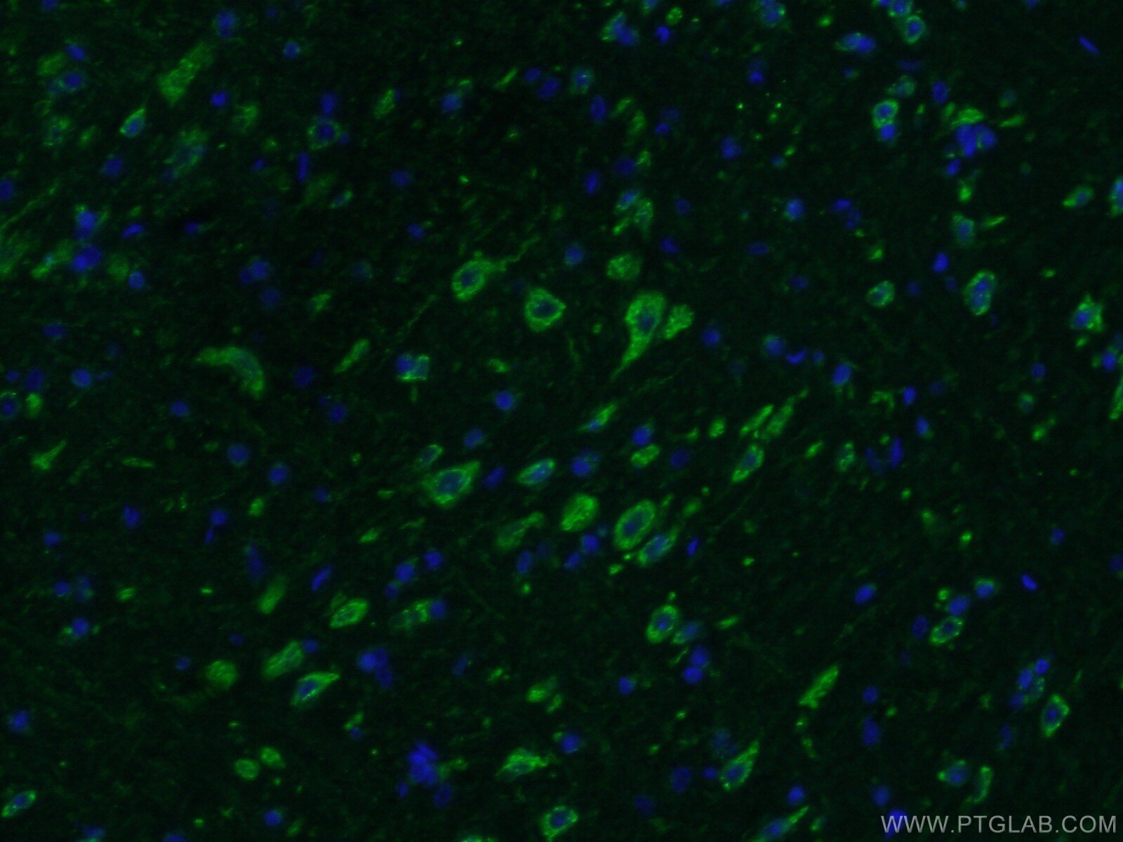 IF Staining of mouse brain using 10228-1-AP