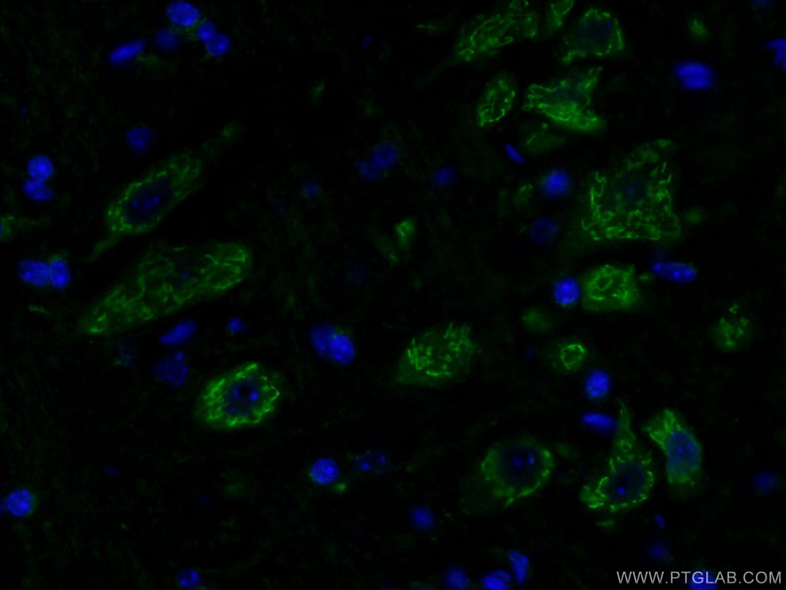 Immunofluorescence (IF) / fluorescent staining of mouse brain tissue using nucleobindin 1 Polyclonal antibody (10228-1-AP)