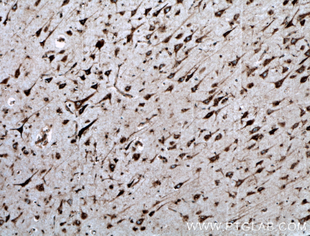 Immunohistochemistry (IHC) staining of human brain tissue using nucleobindin 1 Polyclonal antibody (10228-1-AP)
