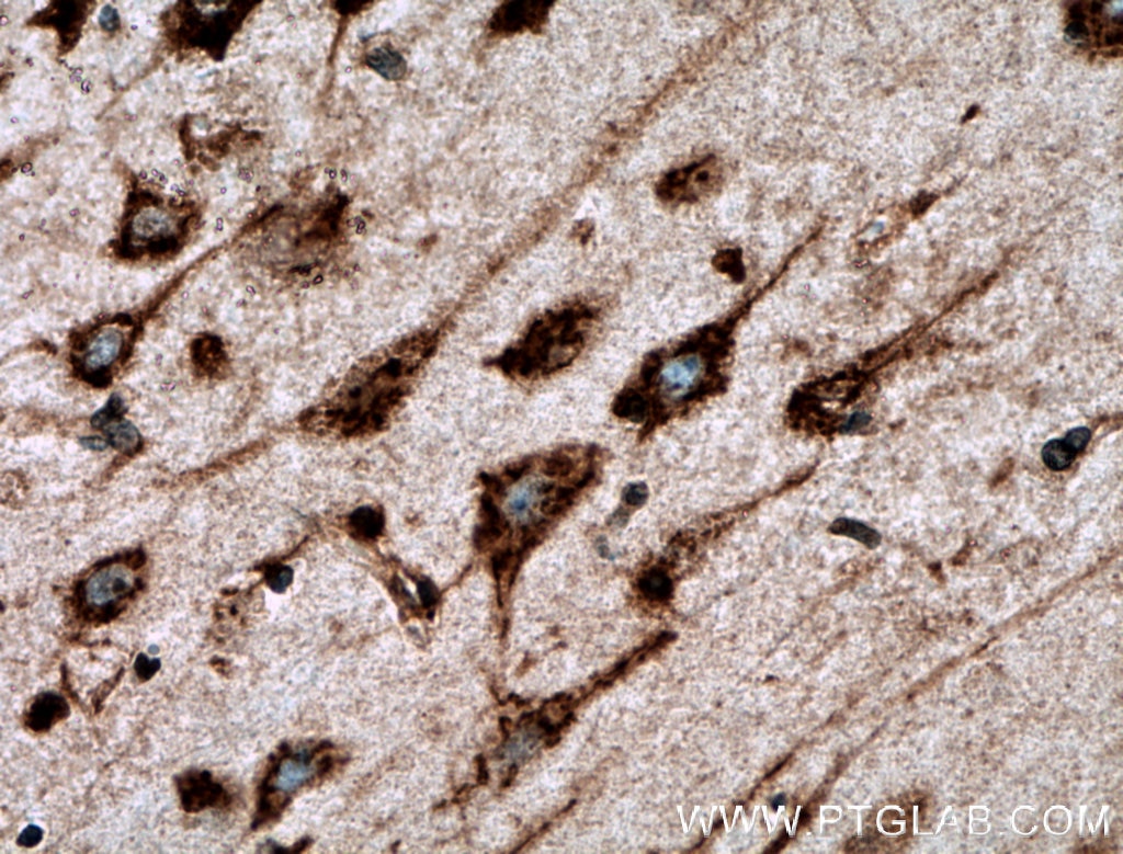 Immunohistochemistry (IHC) staining of human brain tissue using nucleobindin 1 Polyclonal antibody (10228-1-AP)