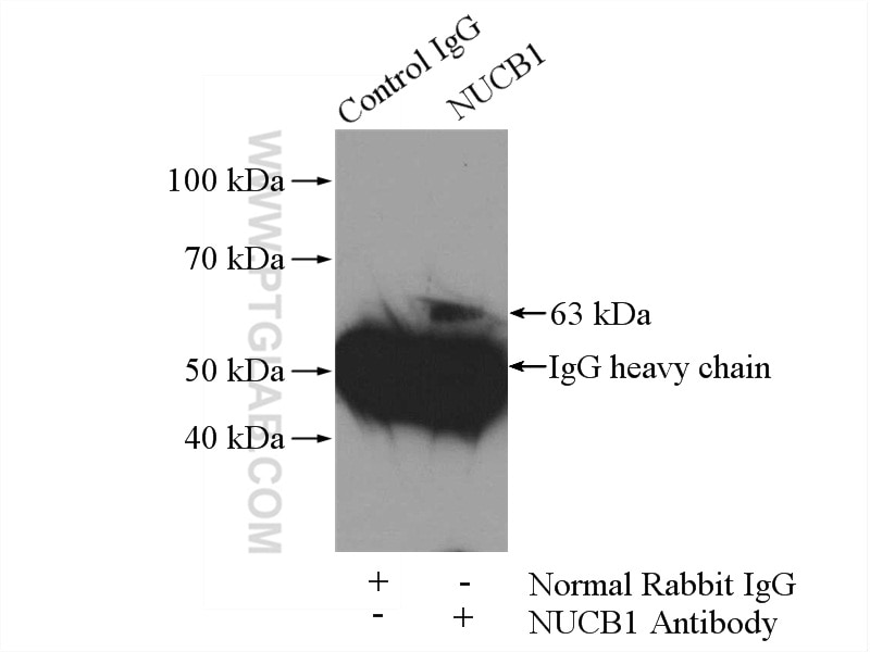 Immunoprecipitation (IP) experiment of HepG2 cells using nucleobindin 1 Polyclonal antibody (10228-1-AP)