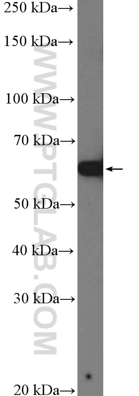Western Blot (WB) analysis of HeLa cells using nucleobindin 1 Polyclonal antibody (10228-1-AP)