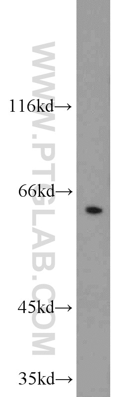 Western Blot (WB) analysis of HepG2 cells using nucleobindin 1 Polyclonal antibody (10228-1-AP)