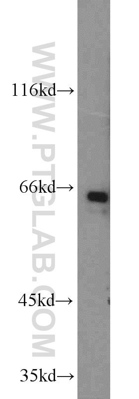 Western Blot (WB) analysis of MCF-7 cells using nucleobindin 1 Polyclonal antibody (10228-1-AP)