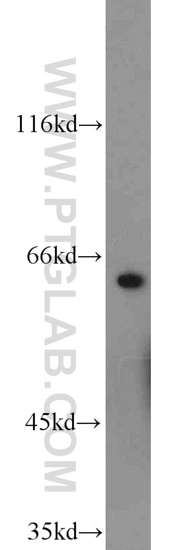 Western Blot (WB) analysis of A431 cells using nucleobindin 1 Polyclonal antibody (10228-1-AP)