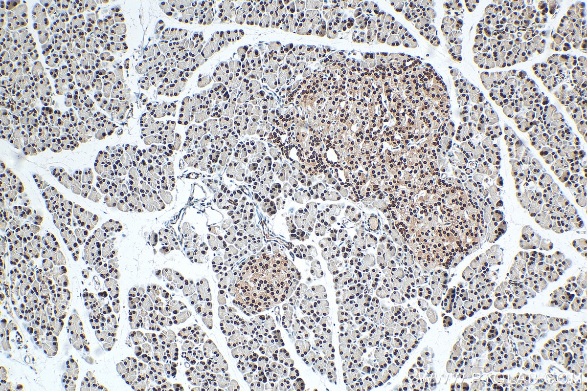 Immunohistochemistry (IHC) staining of rat pancreas tissue using NUCKS1 Polyclonal antibody (12023-2-AP)