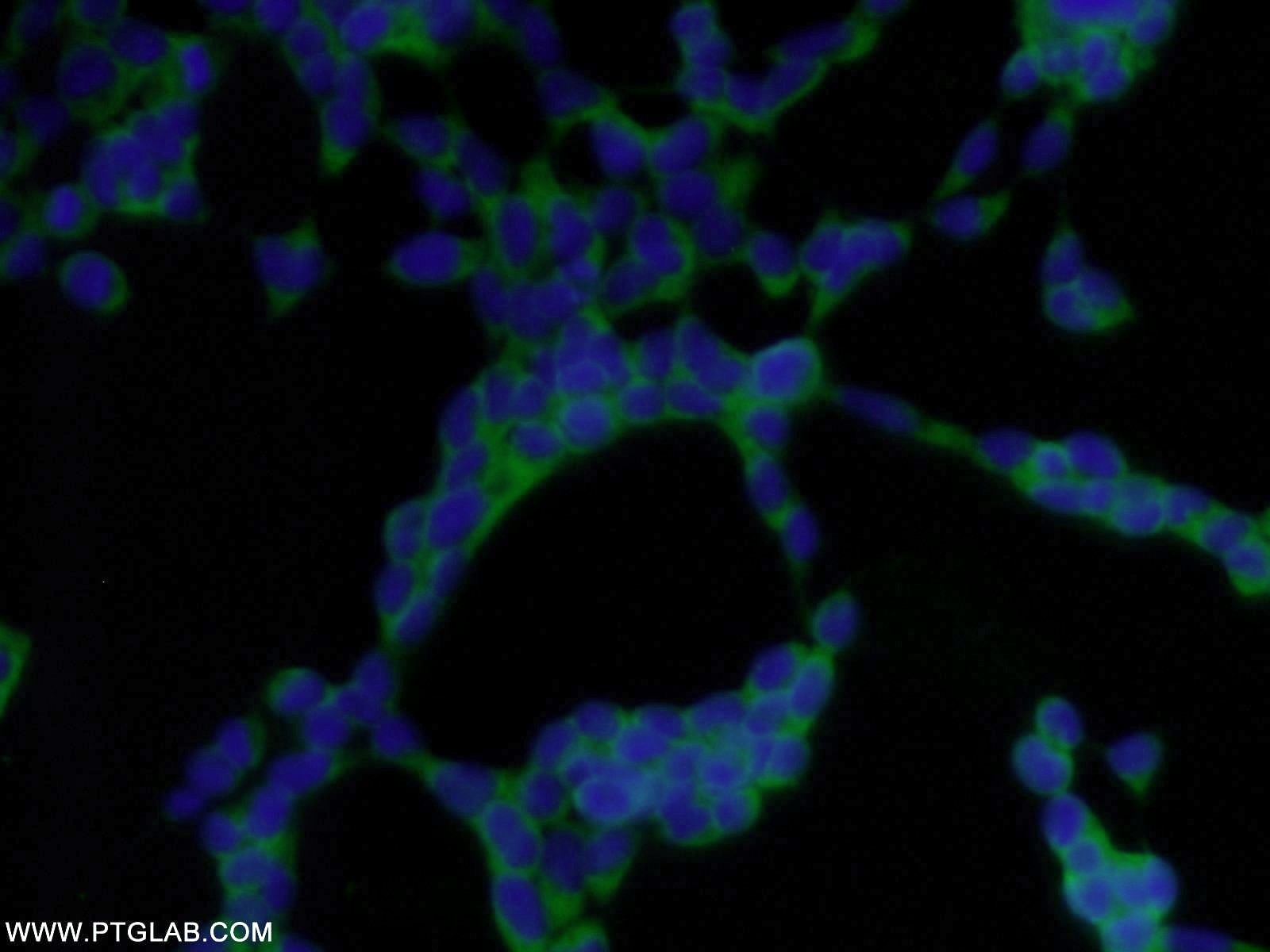 Immunofluorescence (IF) / fluorescent staining of HEK-293 cells using NUDC Polyclonal antibody (10681-1-AP)