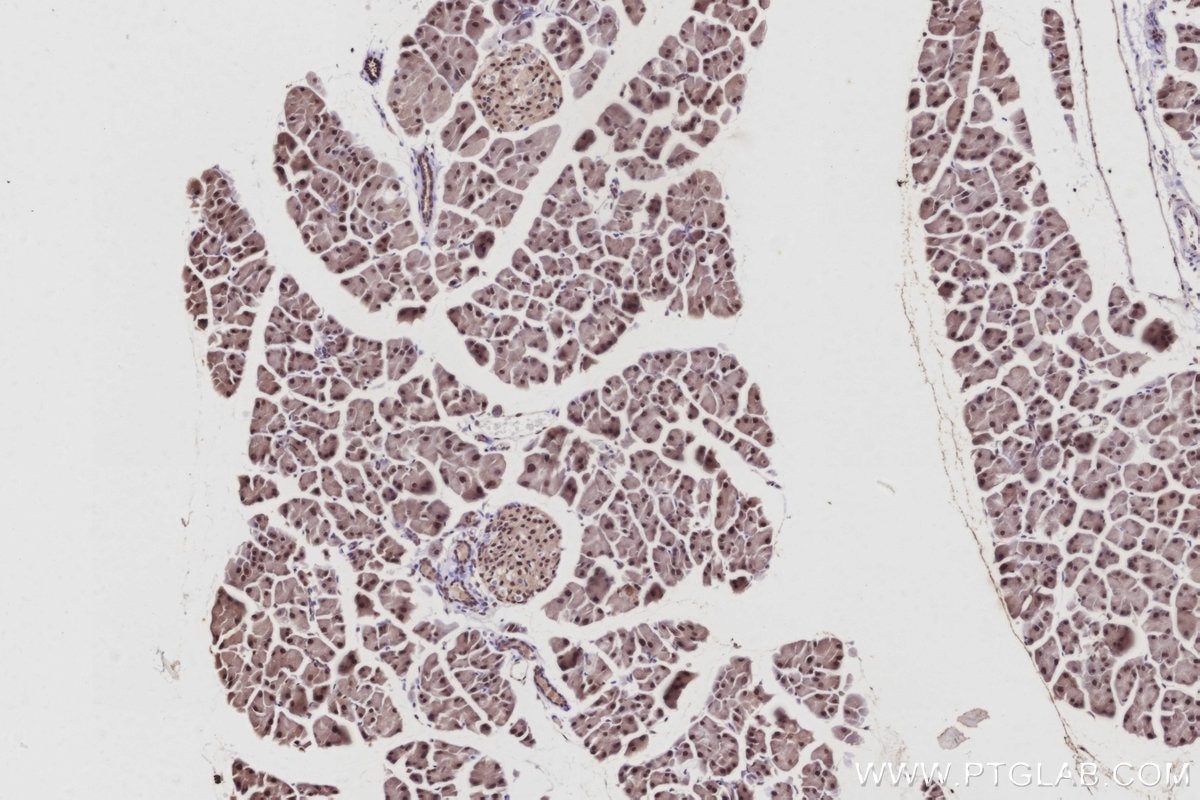 IHC staining of mouse pancreas using 10681-1-AP Immunohistochemistry (IHC) staining of mouse pancreas tissue using NUDC Polyclonal antibody (10681-1-AP)