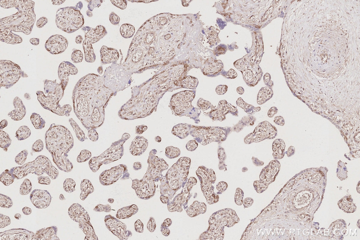 IHC staining of human placenta using 10681-1-AP Immunohistochemistry (IHC) staining of human placenta tissue using NUDC Polyclonal antibody (10681-1-AP)