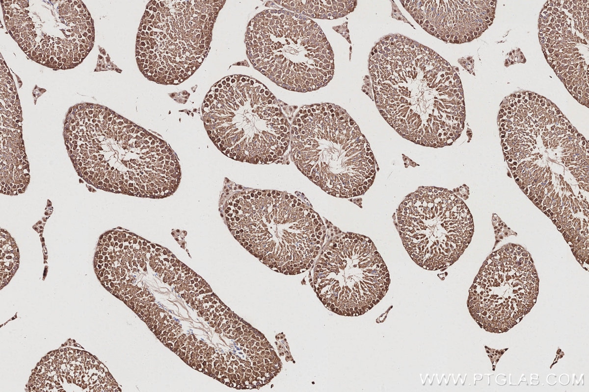IHC staining of mouse testis using 10681-1-AP Immunohistochemistry (IHC) staining of mouse testis tissue using NUDC Polyclonal antibody (10681-1-AP)