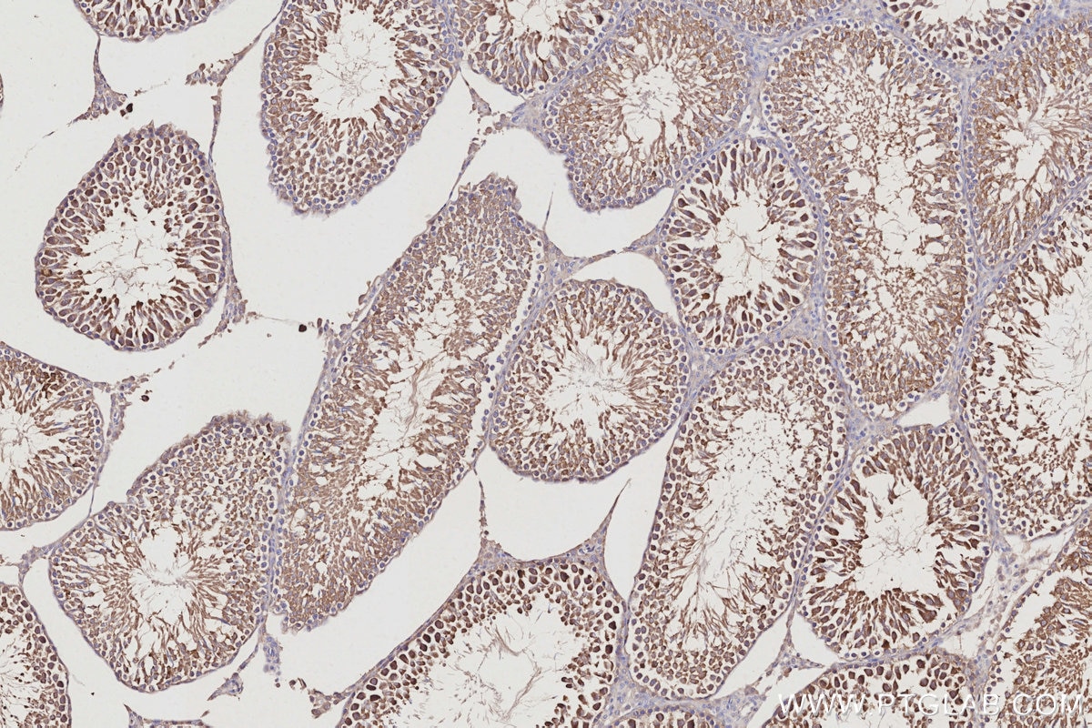 IHC staining of rat testis using 10681-1-AP Immunohistochemistry (IHC) staining of rat testis tissue using NUDC Polyclonal antibody (10681-1-AP)