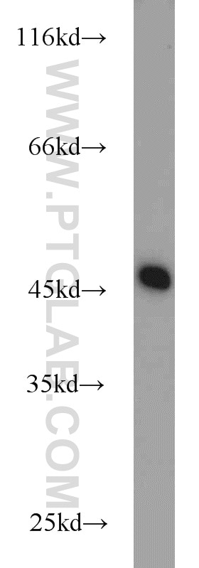 WB analysis of K-562 using 10681-1-AP