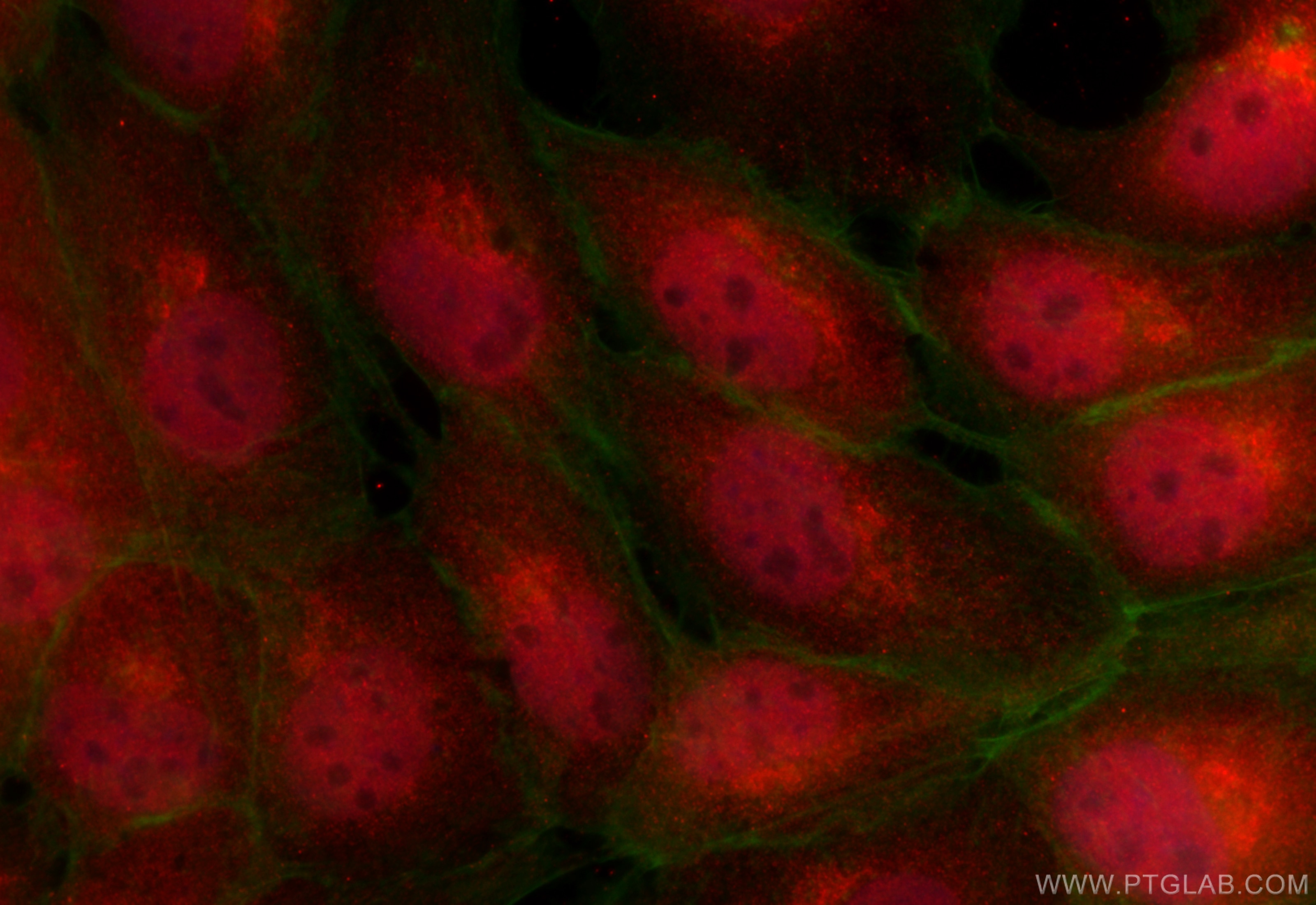 Immunofluorescence (IF) / fluorescent staining of A431 cells using NUDCD1 Polyclonal antibody (32473-1-AP)
