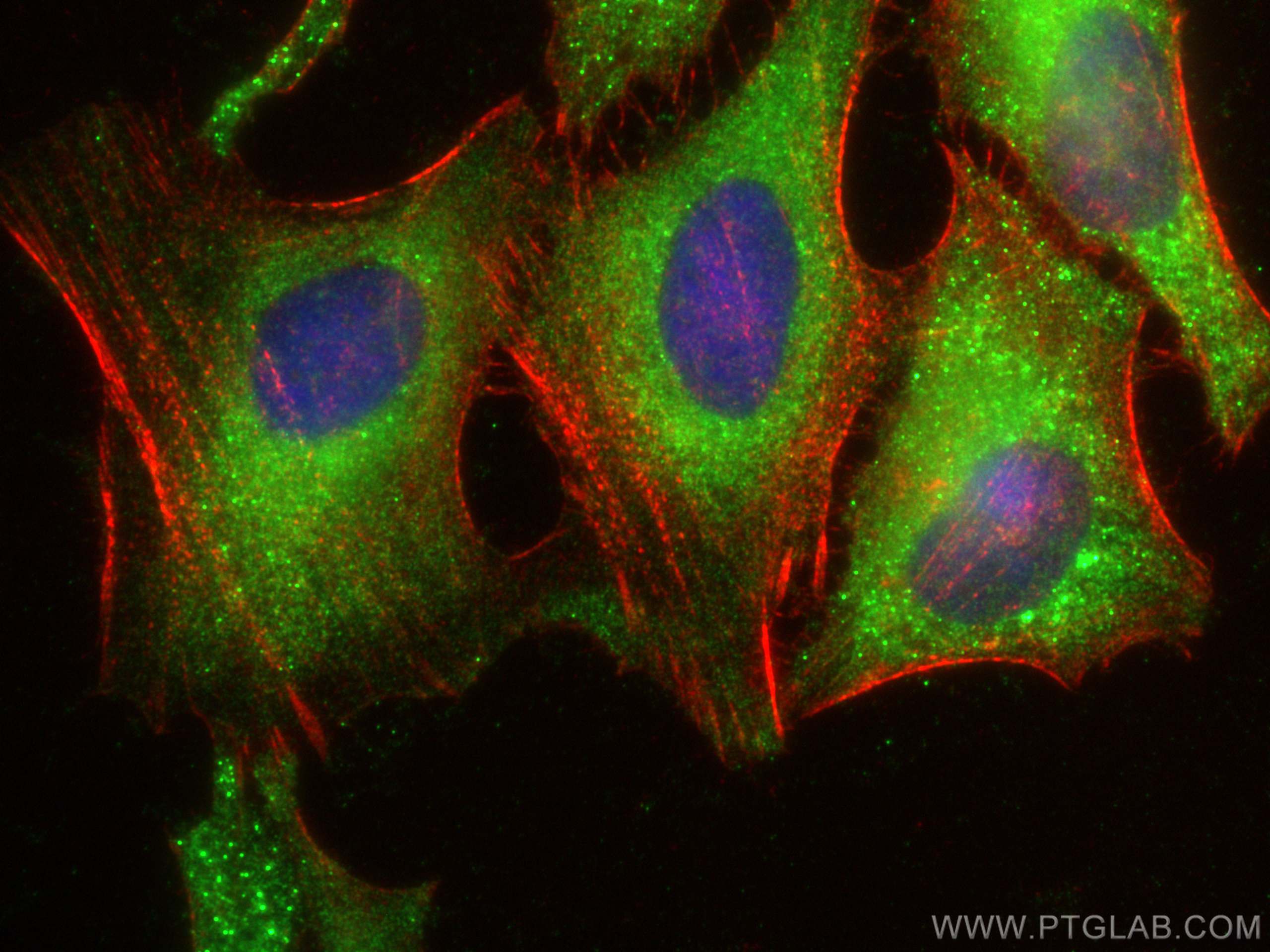 Immunofluorescence (IF) / fluorescent staining of HeLa cells using NUDCD2 Polyclonal antibody (21205-1-AP)