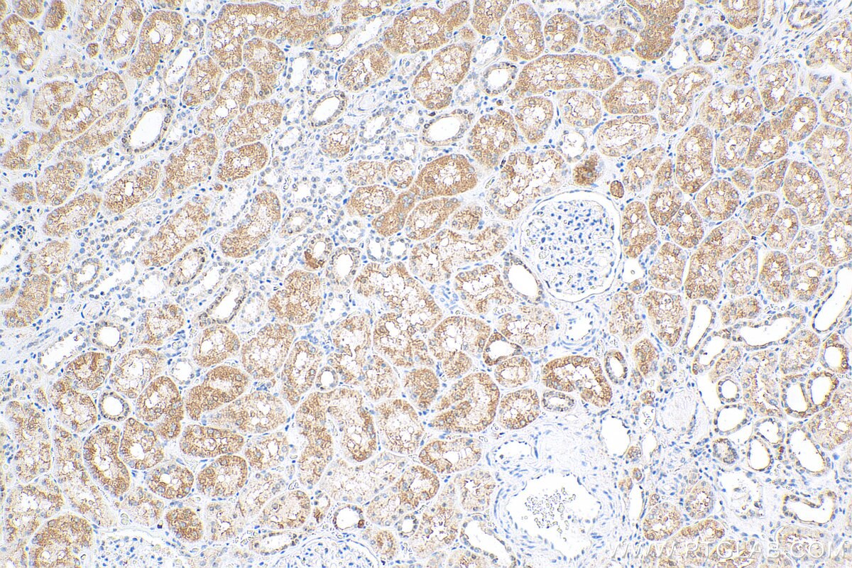 Immunohistochemistry (IHC) staining of human kidney tissue using NUDCD2 Polyclonal antibody (21205-1-AP)