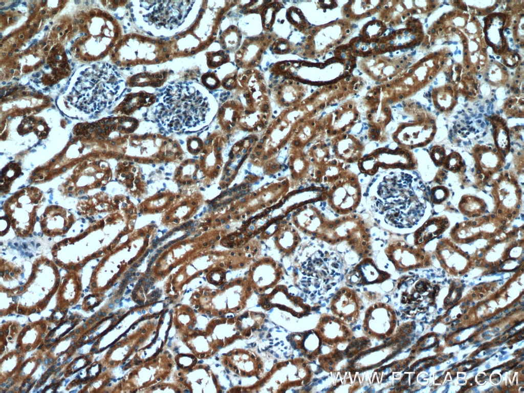 IHC staining of human kidney using 21205-1-AP