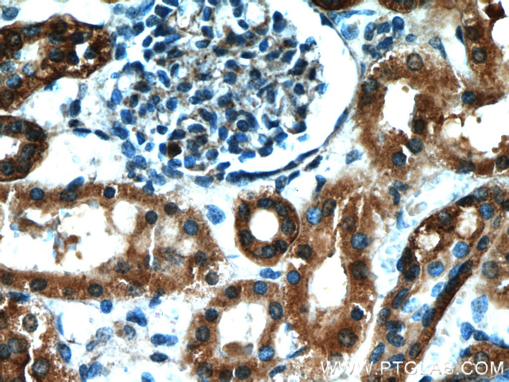 Immunohistochemistry (IHC) staining of human kidney tissue using NUDCD2 Polyclonal antibody (21205-1-AP)
