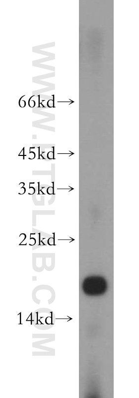 Western Blot (WB) analysis of human brain tissue using NUDCD2 Polyclonal antibody (21205-1-AP)