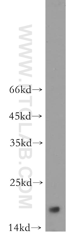 Western Blot (WB) analysis of HEK-293 cells using NUDCD2 Polyclonal antibody (21205-1-AP)