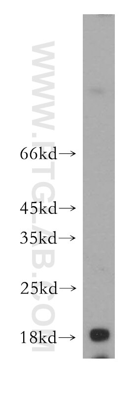 Western Blot (WB) analysis of human kidney tissue using NUDCD2 Polyclonal antibody (21205-1-AP)