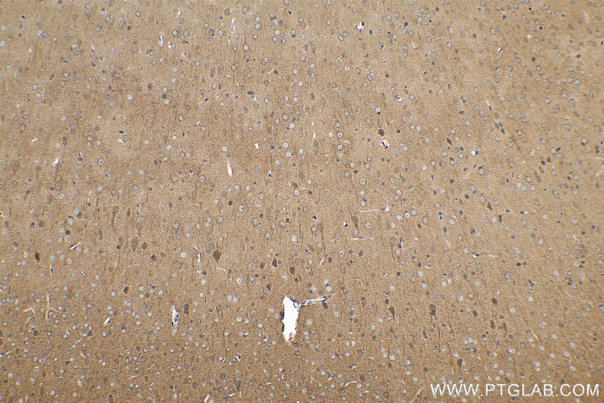 Immunohistochemistry (IHC) staining of mouse brain tissue using MTH1 Polyclonal antibody (16705-1-AP)