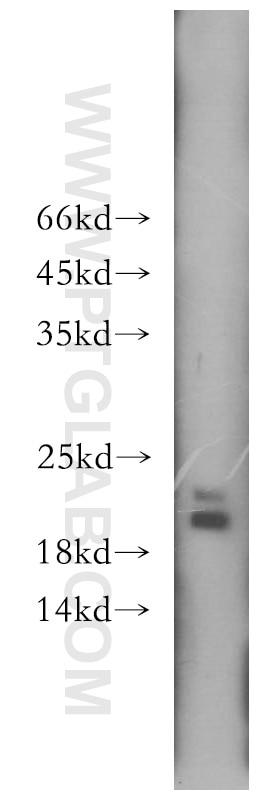 Western Blot (WB) analysis of HEK-293 cells using MTH1 Polyclonal antibody (16705-1-AP)