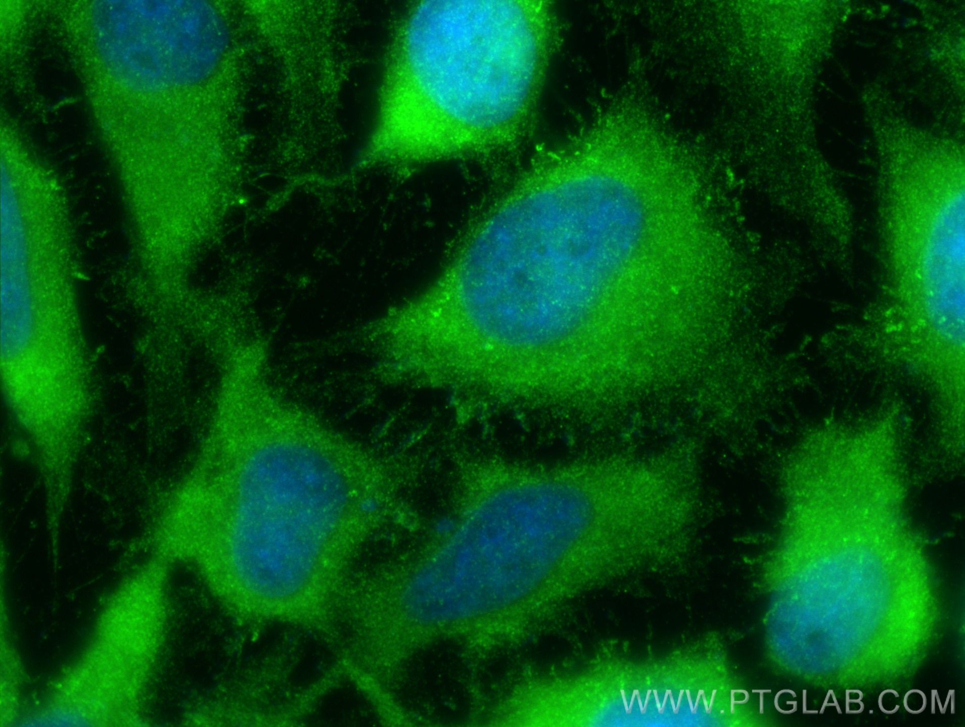 Immunofluorescence (IF) / fluorescent staining of HeLa cells using NUDT3/4/10/11 Polyclonal antibody (17508-1-AP)