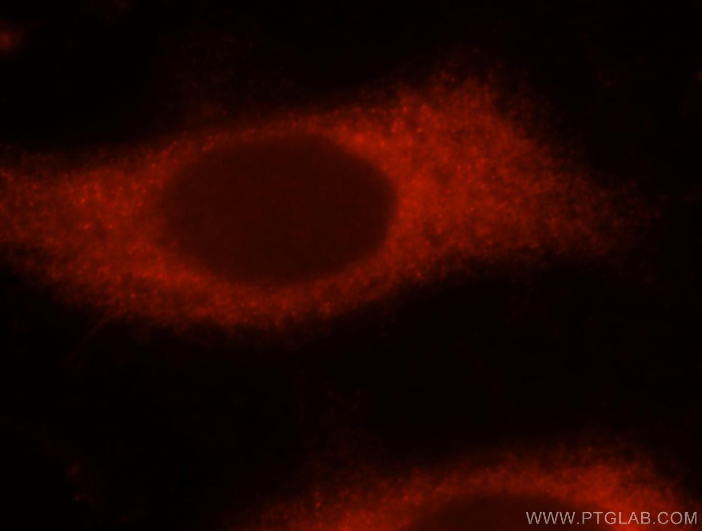 Immunofluorescence (IF) / fluorescent staining of HeLa cells using NUDT3/4/10/11 Polyclonal antibody (17508-1-AP)