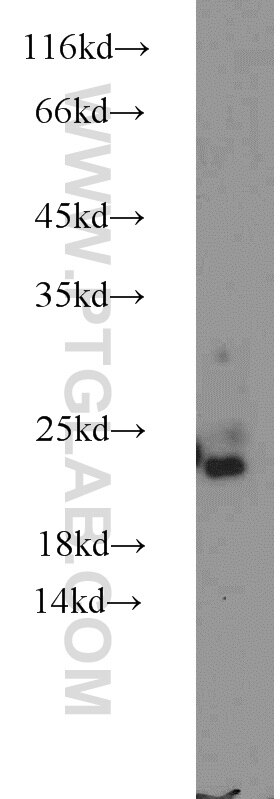 Western Blot (WB) analysis of mouse brain tissue using NUDT3/4/10/11 Polyclonal antibody (17508-1-AP)