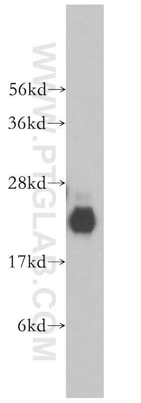 Western Blot (WB) analysis of human brain tissue using NUDT3/4/10/11 Polyclonal antibody (17508-1-AP)