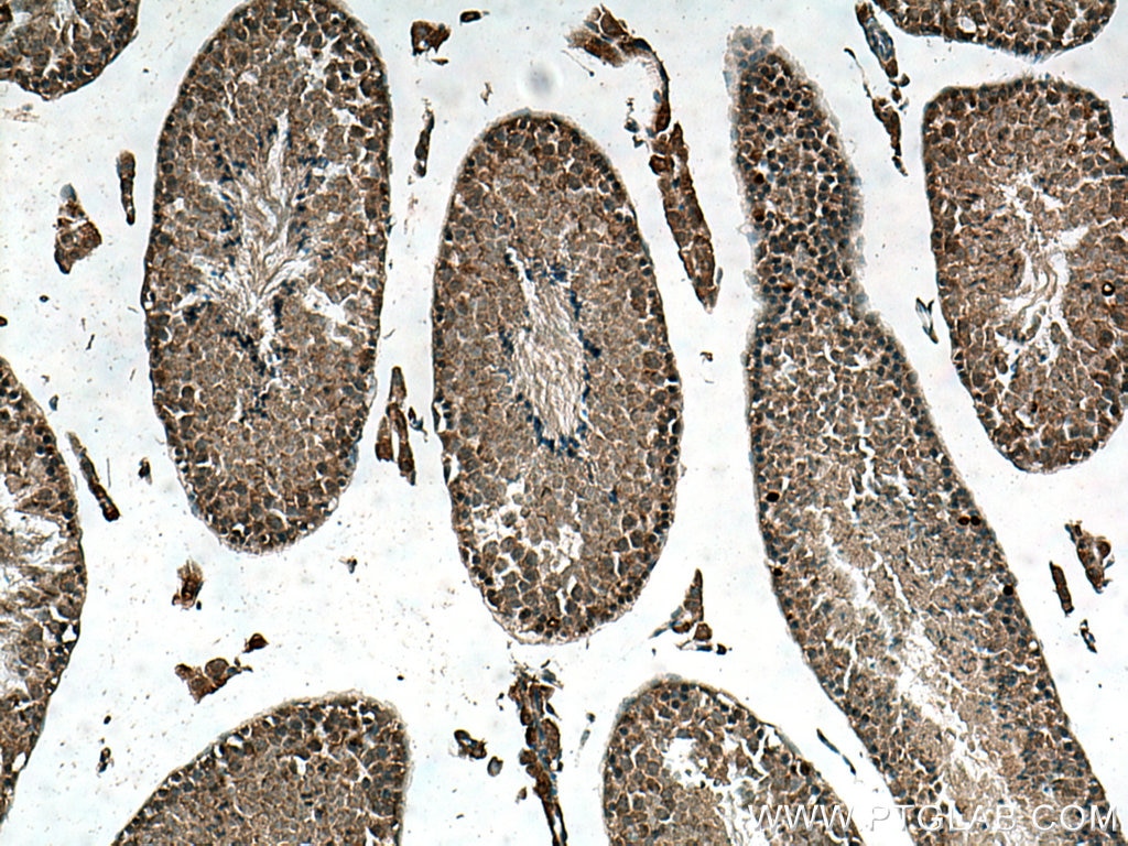 Immunohistochemistry (IHC) staining of mouse testis tissue using NUDT3/4/10/11 Polyclonal antibody (10912-1-AP)