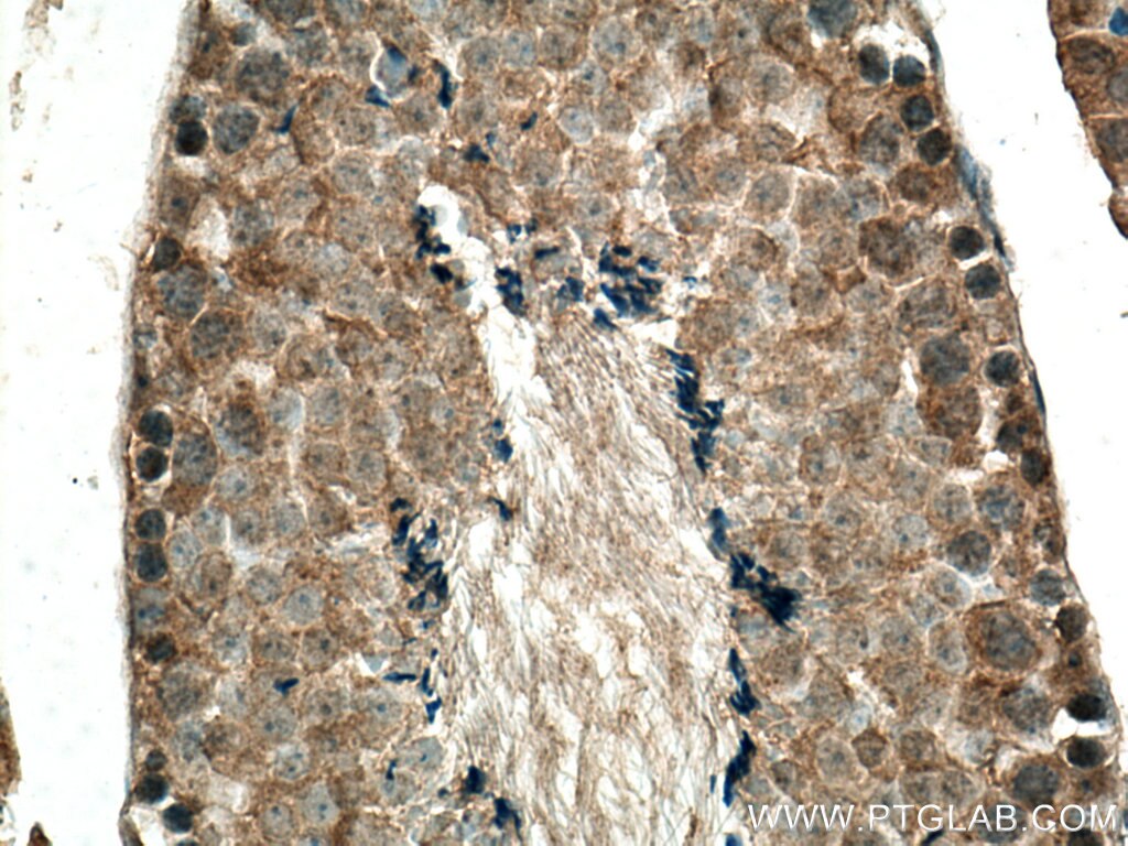 Immunohistochemistry (IHC) staining of mouse testis tissue using NUDT3/4/10/11 Polyclonal antibody (10912-1-AP)